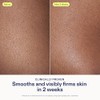 Skin Fix- Crema renovadora Skinfix Resurface AHA de 10 oz