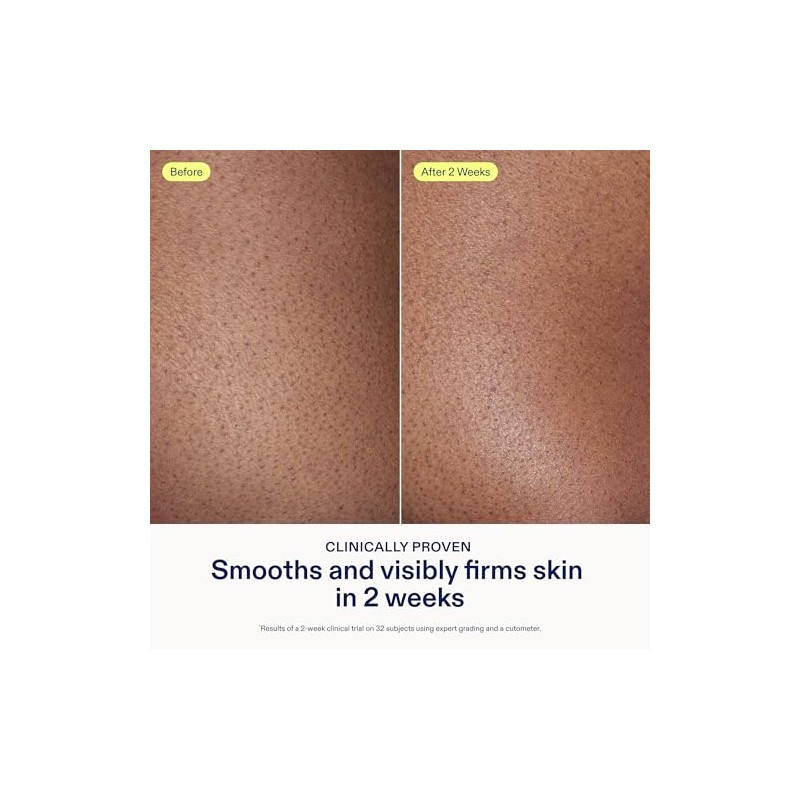 Skin Fix- Crema renovadora Skinfix Resurface AHA de 10 oz