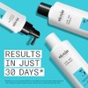 Nioxin System 3 Kit (300ml) Cleanser Shampoo, Scalp Therapy Conditioner,