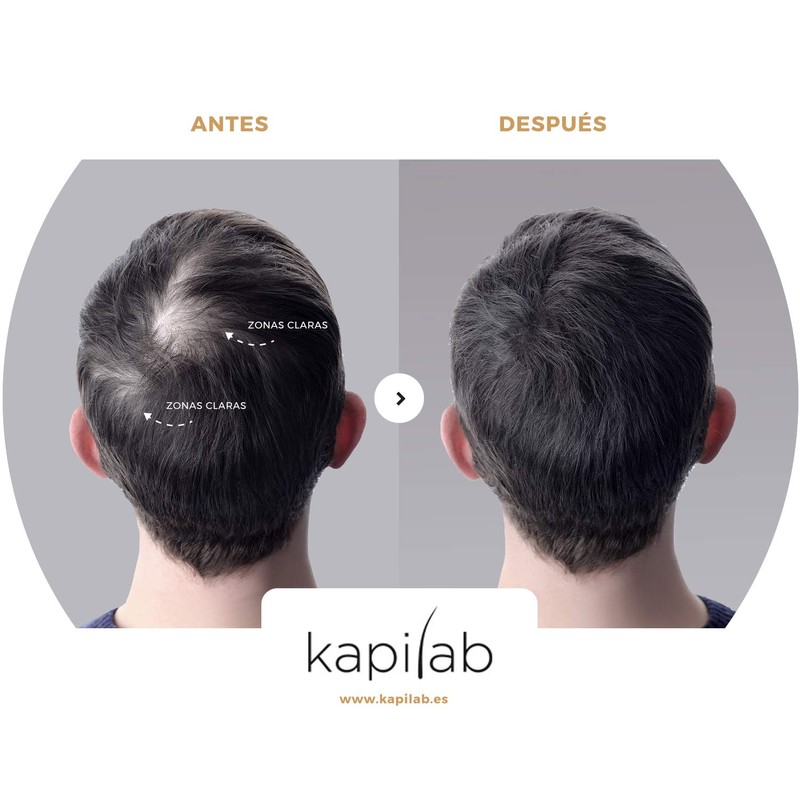 Kapilab Scalp Mask Roots Powder 4 g - Medium Brown