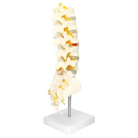 QWORK Life-Size Human Spine Model with 5 Lumbar Vertebrae and Herniation Discs - Ideal for Medical Teaching and Scientific Classroom