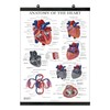 Palace Learning Heart Anatomy Poster - LAMINATED WITH PLASTIC FRAME
