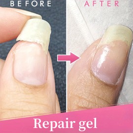Nail Repair Kit For Broken Natural Nails - Nail Glue For Broken Nail Set - Fibreglass Repair Kit Nail Extension - Broken Nail Repair Nail Hardener Quick Builder Gel Nail Glue Nail Extensions