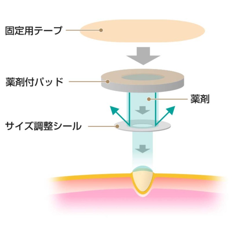 Nichiban Foot Care Spiel Plaster Free Size SPF