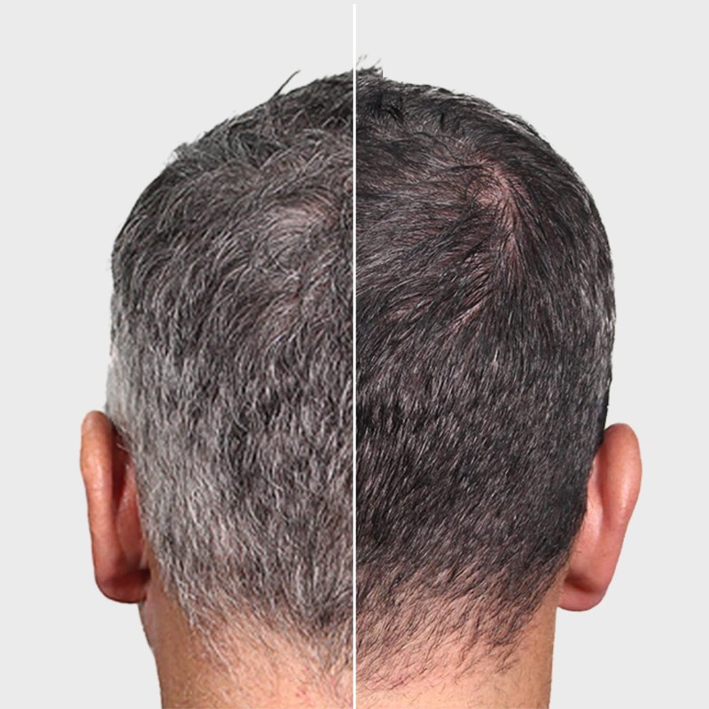 Verseo Grayban Hairspray Color Restorer for Gray Hair, Non-Dye Color