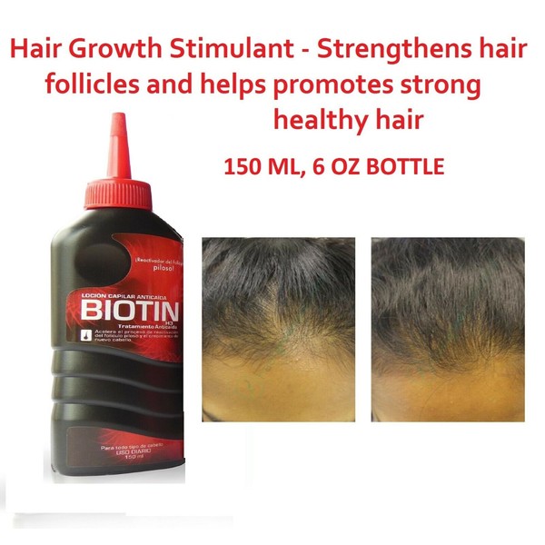 Hair Growth Intesive Biotin Hair Regrowth Treatment Tonic 150 ML Loción Capilar