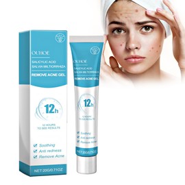 Spot Cream 20g, Facial Acne Treatment Gel for Spot Prone Skin, Daily Facial Moisturizer for Acne Prone Skin and Blemish Control