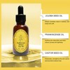 Frankincense Resin Oil for Face, Frankincense Oil for Skin, Frankincense
