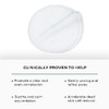 Replenix Acne Solutions Gly-Sal 5-2 Exfoliating Acne Pads with Glycolic