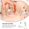COLLBATH COLLBATH 2pcs Negative Pressure Massage Cups for Cupping Therapy