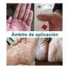 Artken Reparación Para Pies Agrietados Y Resecos - Crema