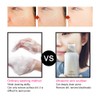 Ultrasonic Skin Scrubber Blackhead Removal Exfoliating Face Massage Pore Cleaner