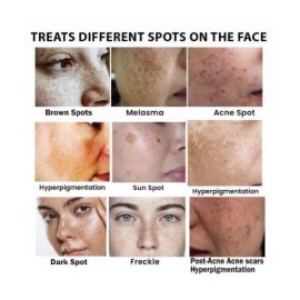 CEAVO DARK SPOT REMOVER FOR FACE 1.06 FL OZ