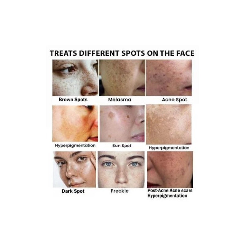 CEAVO DARK SPOT REMOVER FOR FACE 1.06 FL OZ