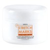 Crema Para Estrías