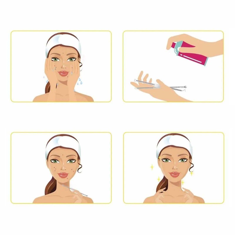 10pcs Pimples Needles Carbon Steel Portable Blackheads Removal Multifunctional Face