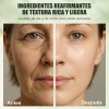 Noni Ampoule 50ml Sérum Facial Día/noche Todo Tipo De Piel