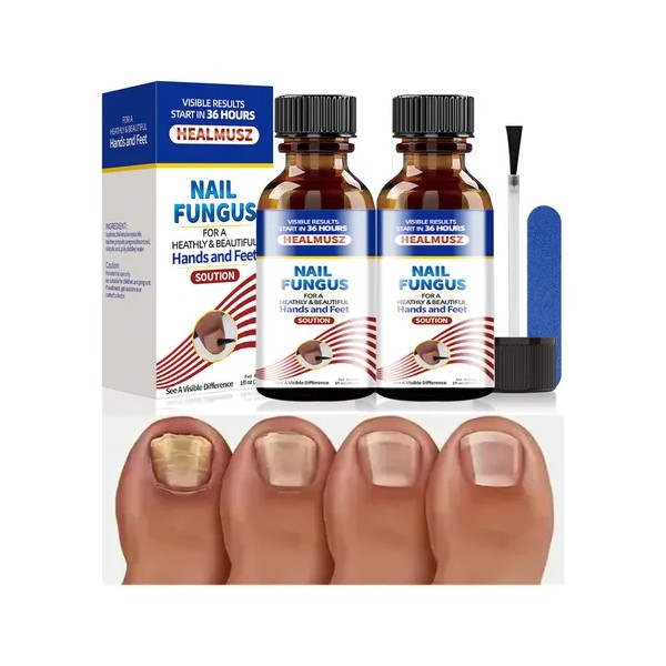 Líquido De Eliminar Los Hongos De Las Uñas Reparar Uñas