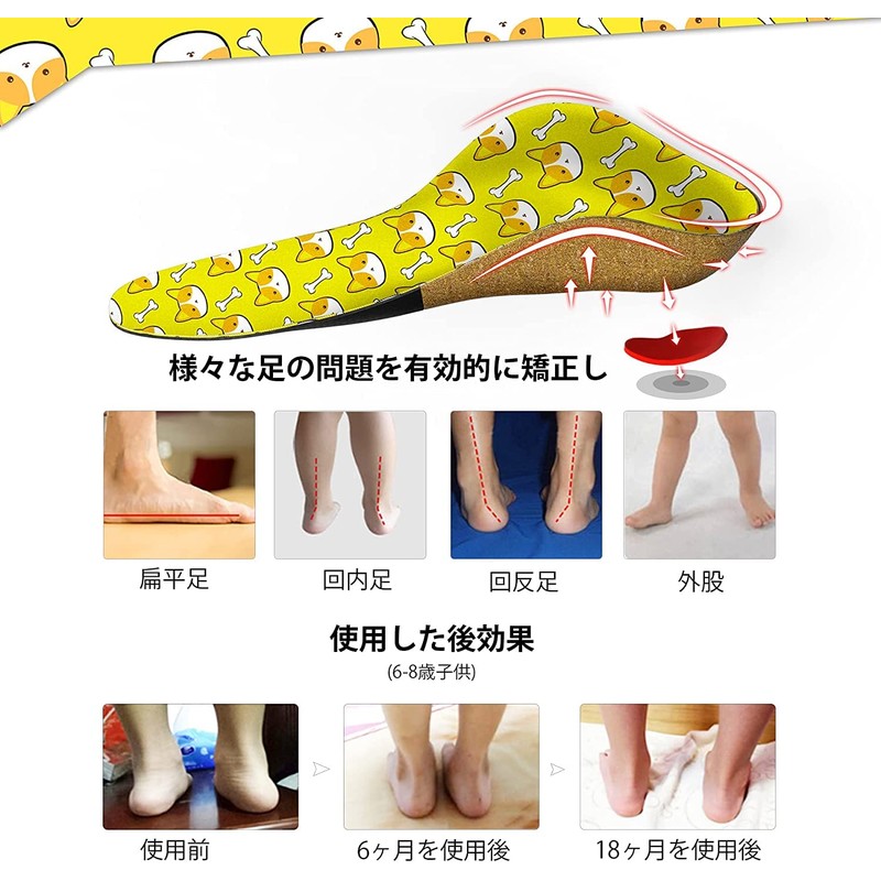 Children's Orthopedic Insoles Flat Feet Insoles Shock Absorbing Standing Work