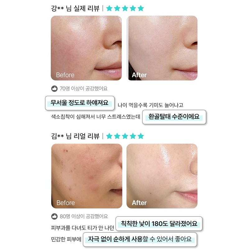 Shard Melacare Peel Cream Mask + Brush + Snow Ampoule
