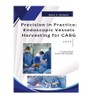Precision in Practice: Endoscopic Vessel Harvesting for CABG