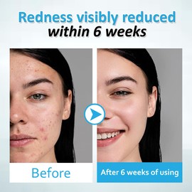 RAQK 100 Pcs Ultra Soft Face Towels for Gentle Skincare – 25cm x 35cm – disposable face towel 100% Vegan Clinically Tested 100% USDA Bio-Based