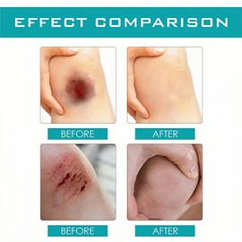 Liquid Plaster Quick-Dry Gel,Skin Glue for Wounds Human,Waterproof Skin Glue,Quick Drying Protective Film,Breathable Quick Dry for Wounds,Waterproof Transparent Breathable,No Pain,Dry Cracked Skin