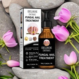 EELHOE Vitamin E & Plant Essential Oils for Nail Care - Supports Gray Nails, Nail Groove Inflammation & Nail Deformation with Comfortable Experience Repair Manicure - Specification: 1