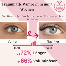 drytogo Umbrella - Automatically Close and Open - Wind Resistant - Pocket Umbrella with Non-Slip Handle - for Men, Women and Teenagers, pink