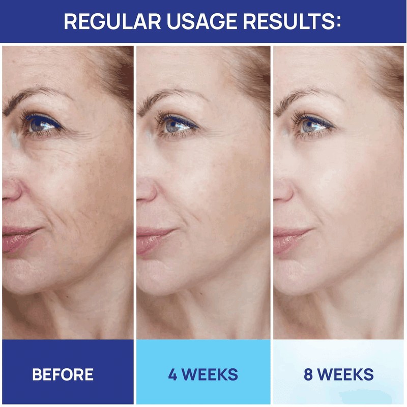 Moonrin Retinol Cream for Face Collagen and Retinol Moisturizer with