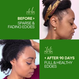 Svvimer Batana Oil for Hair Growth - 100％ Pure & Raw Batana Oil from Honduras Dr. Sebi - Organic & Natural - Promotes Hair Thickness for Men Women 4 Fl Oz (Pack of 1)