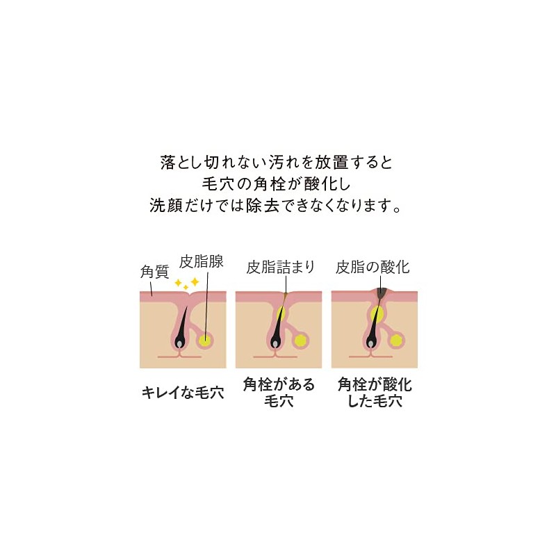 Peeling Soap AHA 1.5% Retinol Formulated 3.5 oz (100 g)