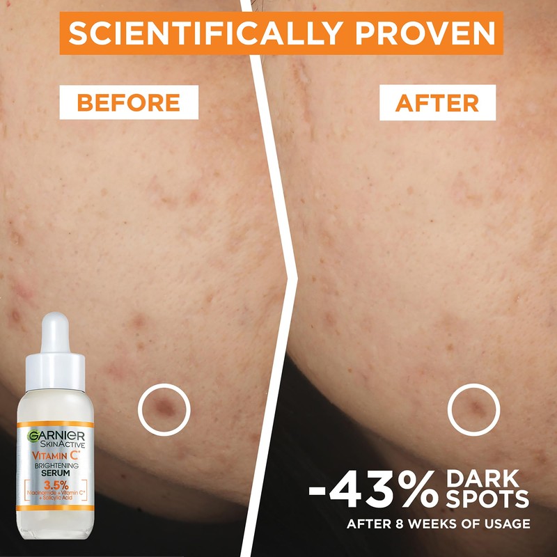 Garnier Naturals Vit C Anti-Dark Spot Serum 30Ml