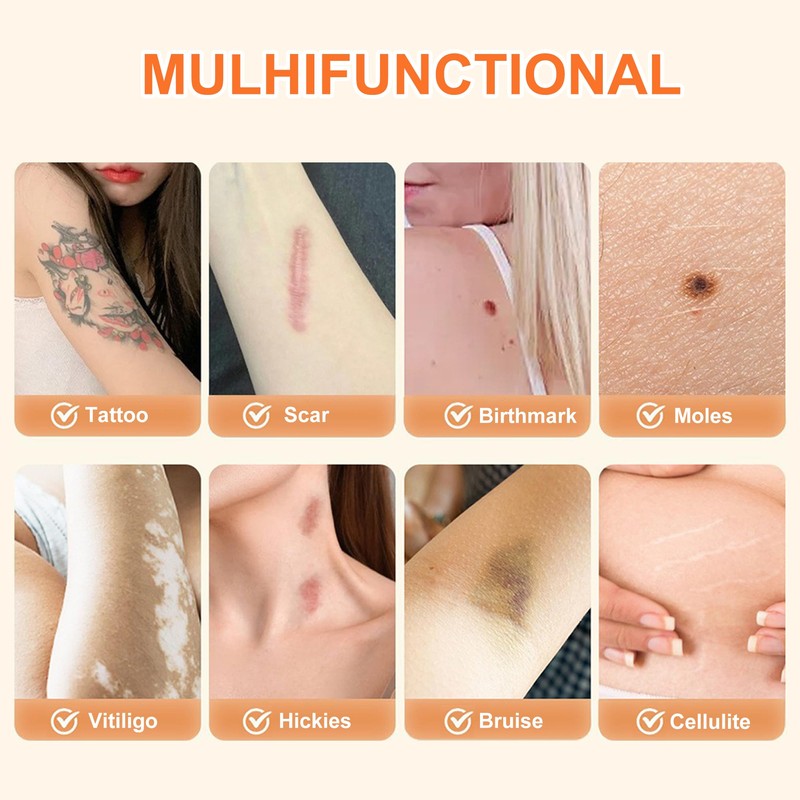 8 Pack Tattoo Cover Up Patch, Ultra Thin Waterproof &