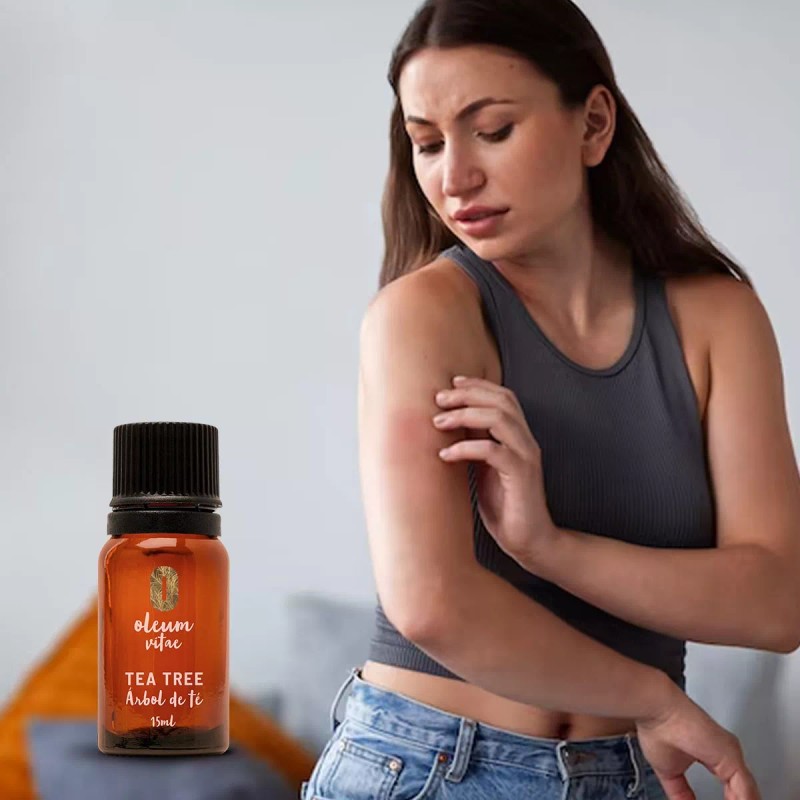 Oleum Vitae Kit Aceites Esenciales Orégano Y Árbol De Té