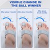 DGMI Adjustable Hallux Valgus Splint, Hallux Valgus Correction, Hallux Valgus
