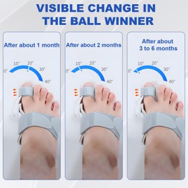 DGMI Adjustable Hallux Valgus Splint, Hallux Valgus Correction, Hallux Valgus Correction Set, Reduces Hallux Valgus Strain for Men and Women