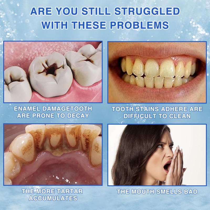 Leogony 2 PCS Hydroxyapatite Toothpaste 7.5% for Sensitive, Prevent Tooth