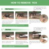 Tick Remover, Tick Removal Tool, Stainless Steel Tick Remover Tool