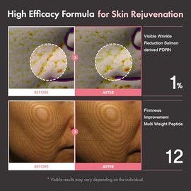 TOSOWOONG PDRN Peptide 12 Capsule Cream, Salmon DNA 10,000ppm, 12 Peptides Moisturizer for Anti Aging, Wrinkle & Fine Lines, 8 Hyaluronic Acids Hydration, Korean Skincare, 50ml / 1.69 fl. oz.
