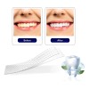 Tiras Blanqueadoras Dentales White Piezas Antideslizantes Higiene Bucal Dmtogeltd