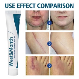 Scar Repair Gel for Surgery & Pregnancy - Cica + Vitamin E, Paraben-Free, Hypoallergenic Skin Care Treatment, Fades Stretch Marks & C-Section Scars, 0.7 oz