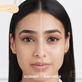 L'Oréal Paris Concealer für ein natürliches Strahlen, Feuchtigkeitsspendend und aufpolsternd, Gesichts Make-Up mit Hyaluronsäure und Koffein, True Match Radiant Serum Concealer 4N, 11 ml