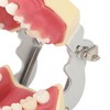 Periodontal Disease Teeth Resin Model Dental Demonstration Teeth Model for
