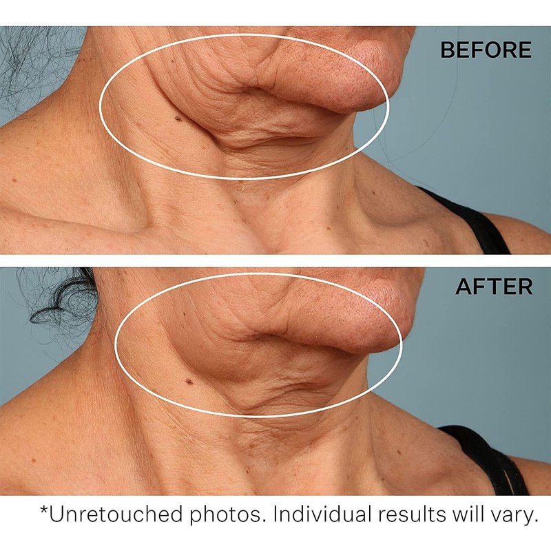 StriVectin, Crema para Cuello para apretar y levantar, 30 ml