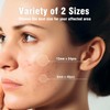 OUKEYA Parches Hidrocoloides Faciales para Imperfecciones, 36 Piezas