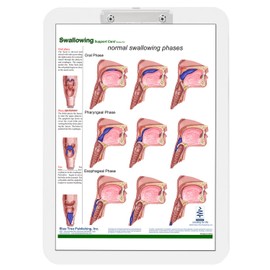 Swallowing Clipboard Two Sided Chart and Dry Erasable