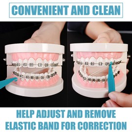 Clyhon Pack of 10 Orthodontic Elastic Disposable Plastic Braces for Braces Material Placement Removal Tools Elastic Rope Hook Elastic Hook Orthodontic