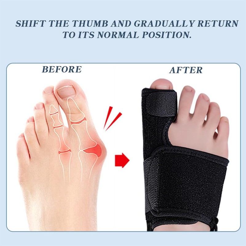 QISANKEE Bunion Corrector for Women and Men big toe,Bunion Relief
