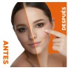 Neoprosone Crema Vitamina C En Gel Neoprosone Despigmentante Aclarante Antimanchas